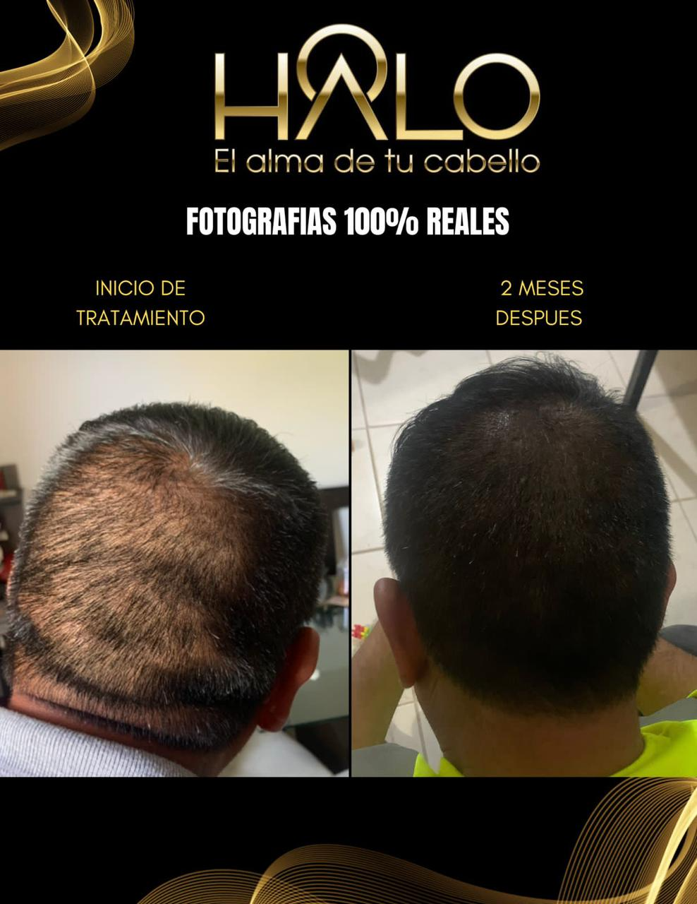 Resultados Antes y Después con HALO